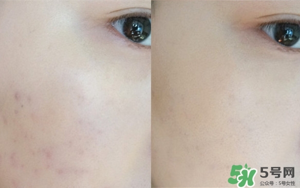 cpb�۵�Һ�ͷ�˪�ĸ��ã�cpb�۵�Һ�ͷ�˪����